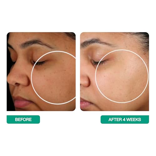 Probiotic Moisturizer with Ceramides & Hyaluronic Acid - 1.7oz - Paraben & Fragrance Free