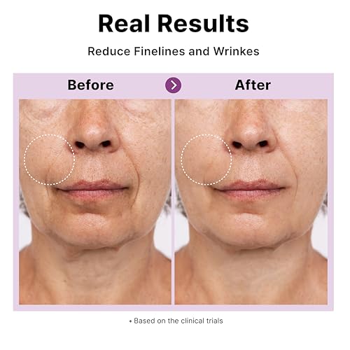 Multi Peptide Complex Serum, Matrixyl 3000, Argireline, Vegan Collagen, Niacinamide, Hyaluronic Acid for Anti-Aging, Anti-Wrinkles, Collagen Boost for Elasticity, Korean Skincare, 1Fl Oz