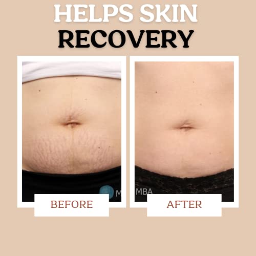 Pregnancy Stretch Mark Cream - Natural Plant-Based Hydration & Skin Elasticity