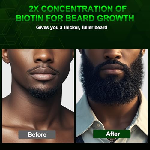 Beard Oil and Beard Balm for Men - Beard Growth Kit for Beard Soften and Moisture - Natural & Organic Jojoba, Argan, Shea Butter - Beard Care Kit for Dad, Husband, Boyfriend, Green