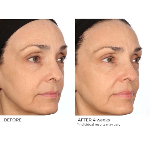 NassifMD Peptide Collagen Serum with Hyaluronic Acid & Beta Glucan for Skin Tightening