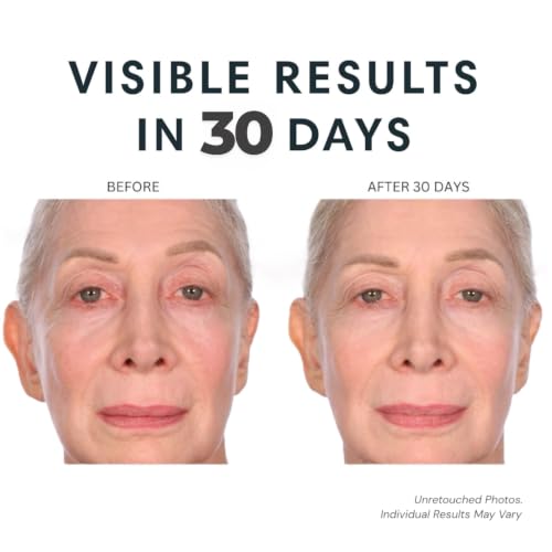 Anti-Aging Face Moisturizer with CoQ10 & Vitamin E - 1 Oz
