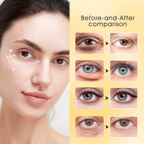 Adofect Under Eye Patches 30 Pairs, 24K Gold Under Eye Mask with Hyaluronic Acid for Dark Circles and Puffy Eyes, Bachelorette Party Accessories, Bridesmaid Gifts, Daily Skin Care