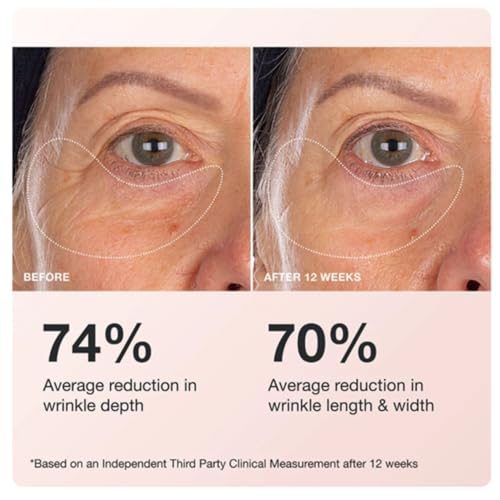Innbeauty Project Extreme Cream Eye Firming & Contouring Refillable Eye Cream, REFILL, 0.5 FL OZ (15ml)