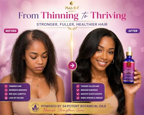 MAKOF BEAUTY Hair Growth Oil 34-in-1 Rapid Nourishing Scalp Treatment - 2 fl oz