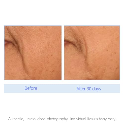 Retinol Face Serum for Anti-Aging & Pore Refinement - 1 Oz