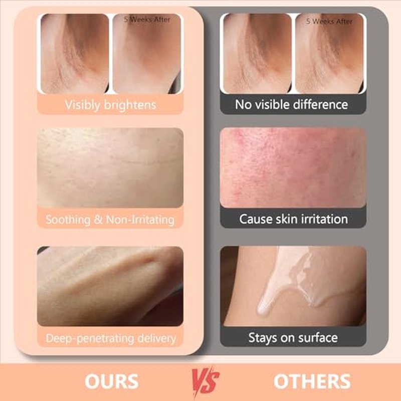 100ml Skin Bleaching Cream - Dark Spots Remover Lightening Cream & Uneven Tone Nourishing Formula Bleaching Intimate Areas & Underarms Inner Thigh, Bikini Line, Armpit Knees Elbows for All Skin Types