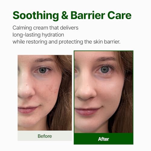 NACIFIC Cica PDRN Barrier Repair Cream, Korean Moisturizer with 76% Centella Asiatica, Skin Barrier Strengthening & Deep Hydration for Dry Sensitive Skin, Low pH Calming Face Cream, 1.76 oz (50g)