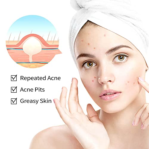 Calming Relief Cream - 8.5 oz / 250 ml - Moisturizing Comfort from Itchy Skin, Helps Alleviate Itch from Eczema, Hives, Sunburn - Vegan Formula with Shea Butter & Tea Tree Oil - by NextGenU