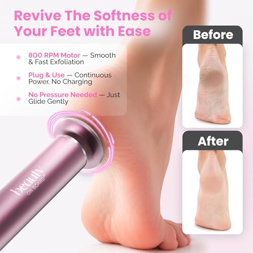 Electric Foot Callus Remover Tool with 60 Sanding Discs & Adjustable Speed – Professional Foot Grinder for Exfoliation