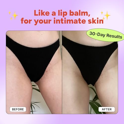 No Burn Balm by OYO ? Razor Burn Relief Balm for Bikini Line, Underarms & Intimate Areas, 100% Natural, Fragrance-Free Soothing Formula with Shea Butter, Calendula & Mango Butter, 60 g