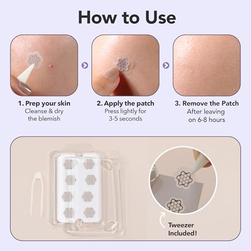 Magnesium Blemish Microdarts | Pimple Patch | Fast-Acting | Quick Calming | 99.9% Pure Magnesium | Madecassic Acid | Tea Tree | Eucalyptus Leaf | Hydrocolloid Spot Care Patch (Large 6 Patches)
