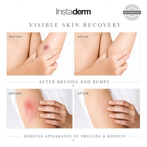 Vitamin K Cream for Bruising & Dark Circles with Arnica - Under-Eye & Skin Care