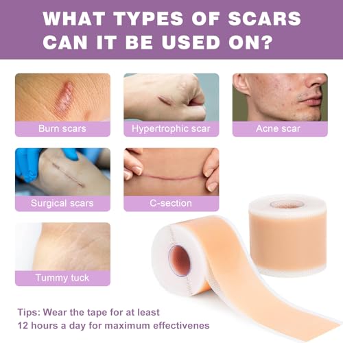 Silicone Scar Sheets 2 Rolls, Silicone Scar Tape (1.6¡± x 120¡± Roll-3M) Pro-Grade Silicone Scar Removal Strips, Reusable, Scar Tape for Wrinkles, Tummy Tuck, C-Section, Keloid, Burn, Acne Scars