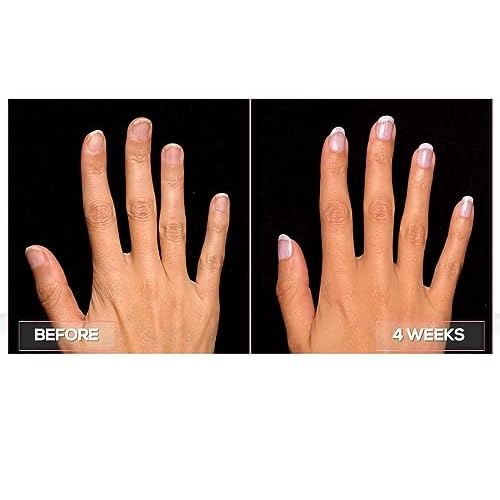 Perfect Formula Manicure Booster - Base and Top Coat Nail Strengthener, Keratin Treatment - Strengthener for Damaged Nails - Made In The USA .60 fl oz.