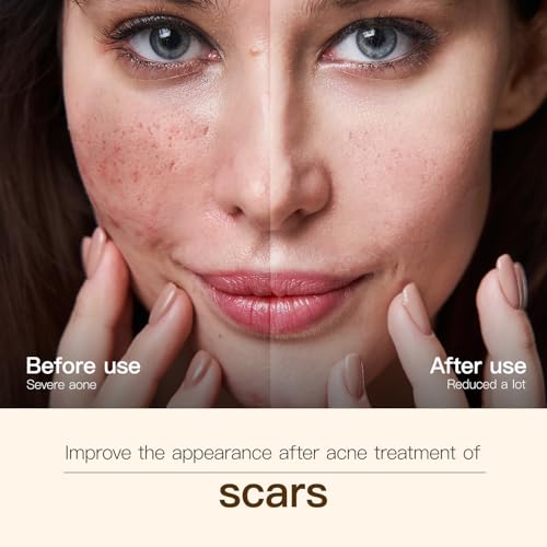 Face Serum with Madagascar Centella & Bakuchiol for Sensitive Skin - 45ml