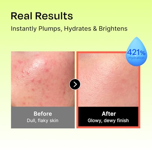 Celladix Hyaluronic Intense Cream ? 95% Pure Hyaluronic Acid with Niacinamide & Panthenol ? 100 Hours of Hydration, Barrier Strengthening Care for Smooth, Radiant Skin ? Korean Skincare, 2.70 Fl Oz