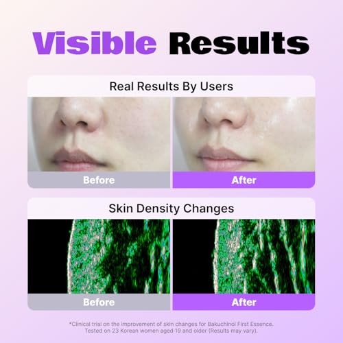 LALARECIPE Bakuchinol First Essence, Bakuchiol + Retinol Milky Toner with Peptides & Niacinamide, Fine Lines, Texture & Dark Spot Care, Korean Skincare for All Skin Types (5.24 Fl Oz / 155ml)