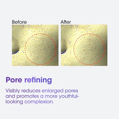 Retinol Eye Cream for Dark Circles and Fine Lines - Brightening & Anti-Aging Serum, 30ml