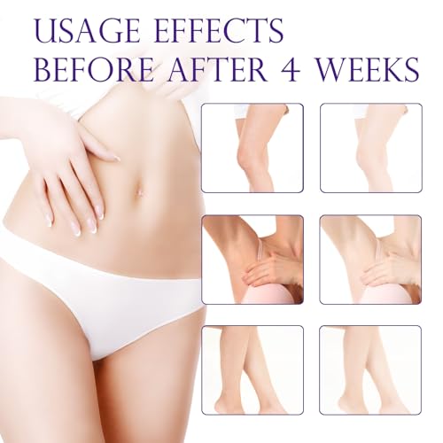 Intimate Bleaching Cream for Women,Skin Lightening Body Whitening Cream for Private Parts,Kojic Acid Brightening Dark Spot Remover for Neck,Armpit,Underarm,Elbow,Inner Thigh and Knees