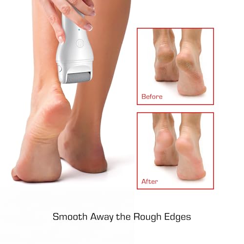 Cordless Electric Foot Callus Remover with Large Roller Heads & Dual Speed - Wet & Dry Use