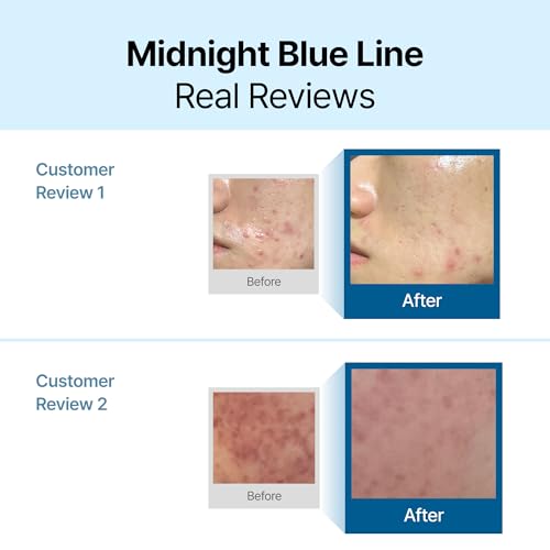 DearKlairs Blue Calming Cream 2.11oz Face Moisturizer for Redness & Irritation Relief