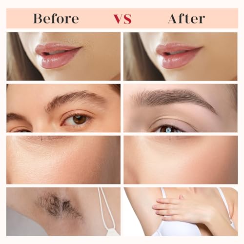 Replacement Heads New Generation 3 for Finishing Touch Flawless Facial Hair Remover Ring Light,New Version Replacement Blades for Women,18K Gold-Plated Rose Gold for Flawless