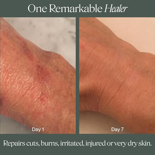 Doctor Rogers Restore Healing Balm. Multi-Purpose Healing Ointment & Moisturizing Relief Gel. Protects & Soothes Injured, Sensitive & Dry Skin. 4 Ounce (114 g) Tube