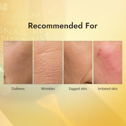 MIZON Snail Repair Intensive Essence 3.38 fl oz - Hydrating Skin Care for Wrinkle & Pore Tightening