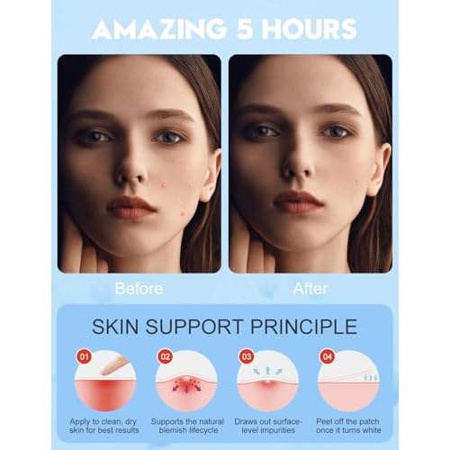 Pimple Patches for Face, 7 Sizes, 5 Shape/Color 250 pcs Acne Patches Hydrocolloid Precise Matches Different Sizes Acne, Spot Stickers With Tea Tree Oil Salicylic Acid Centella Covering Zits Blemishes