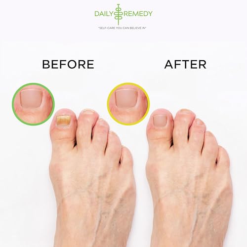 DAILY REMEDY Tea Tree Oil & Citrus Foot Soak Set, Pack of 2, for Foot Pain, Odor, Sore Feet, Athlete¡¯s Foot, Soften Calluses - Natural Blend & Salts, Made In USA