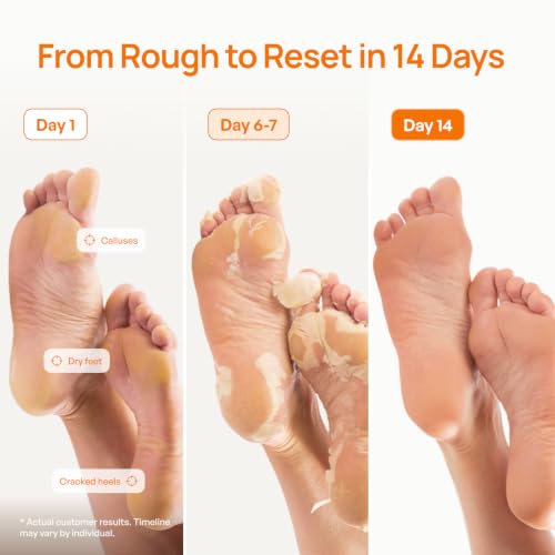 Foot Peeling Mask Set - 4 Pairs Peach Exfoliating Foot Treatment - Derm Tested