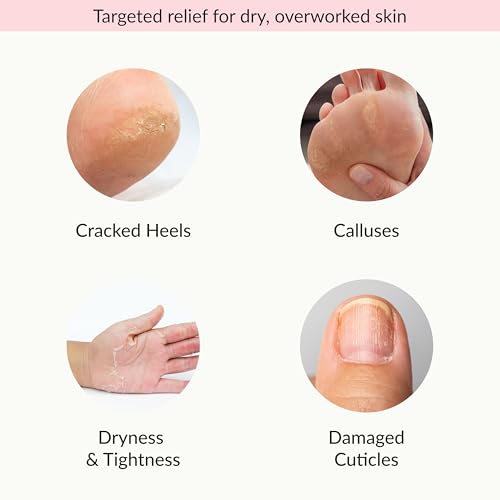 Epielle Moisturizing Hand & Foot Masks, Soften Dry, Rough Skin with Sunflower Seed Oil & Vitamin E, Self Care Gifts for Women, Spa Kit, Stocking Stuffers, 6 Moisturizing Gloves & 6 Moisturizing Socks