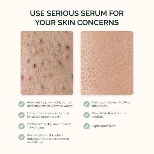 Ingrown Hair Treatment Serum with Salicylic & Glycolic Acid for Face & Body
