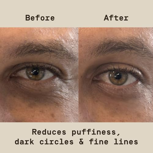Men's Under Eye Patches with Peptides & Hyaluronic Acid - 6 Pack