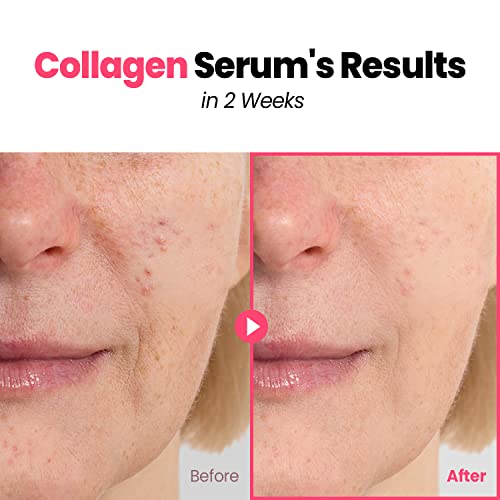 GLAM UP Marine Collagen Serum - Anti-Aging Face Serum with Hyaluronic Acid & Peptides, 30ml