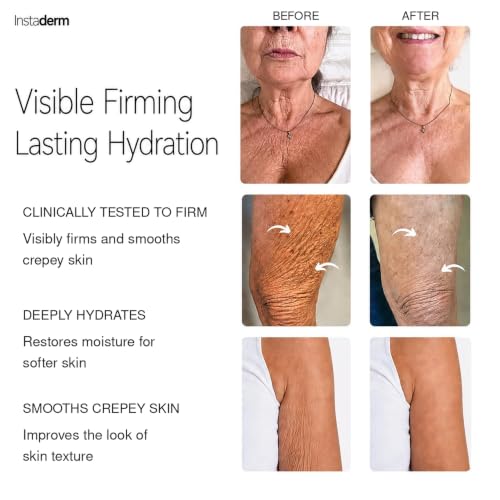 Crepey Skin Firming Body Cream - Anti-Aging Moisturizer for Arms, Legs & Neck
