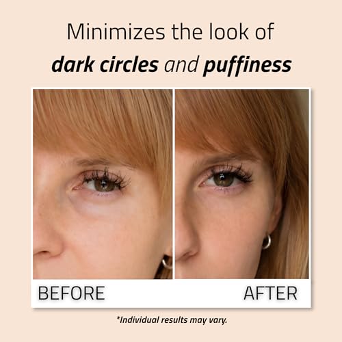 Hydrating Under Eye Gel with Hyaluronic Acid & Peptides – 1oz, for Dark Circles & Puffiness
