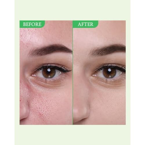 FULLY Green Tomato Pore Detox Set ? Clay Mask Cleanser & Toner Duo | Deep Cleansing, Pore Tightening, Blackhead Care, Hydrating, Fragrance-Free Vegan Korean Skincare Duo Bundle
