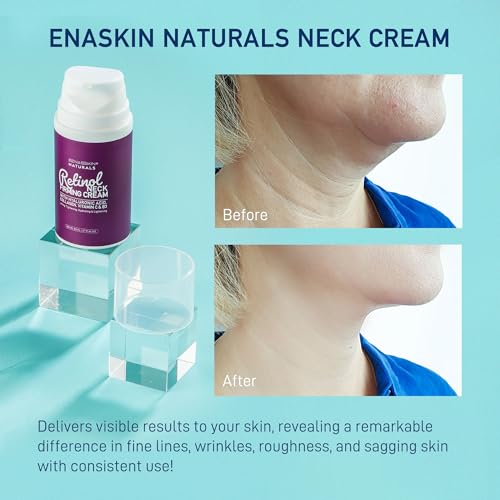 Retinol Neck Firming Cream: Advanced Face Tightening and Lifting Cream with Hyaluronic Acid, Collagen and Vitamin - Tightening Wrinkles, Firming Sagging Skin on Face, Neck, D?collet? - 2.7 Oz
