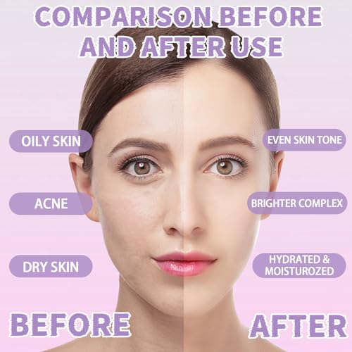 Jelly Mask Set,Hyalorunic Acid Jelly Masks For Facials Professional,Rose Hydro Jelly Face Mask,with Facial Mask Mixing Bowl Set,Headband,Birthday Gifts for Women,Gift Set for Valentine's, Mother's Day