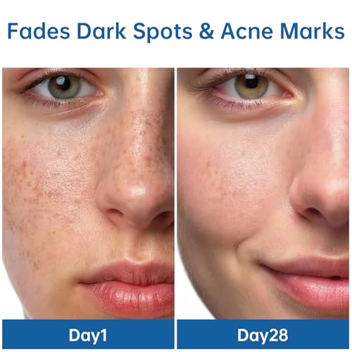 Even Tone & Blemish Serum ? Face Brightening & Dark Spot Correcting Repair Serum with Centella, Niacinamide | Helps Smooth, Hydrate & Nourish, Gentle for Acne-Prone Skin, 1 fl.oz / 30ml