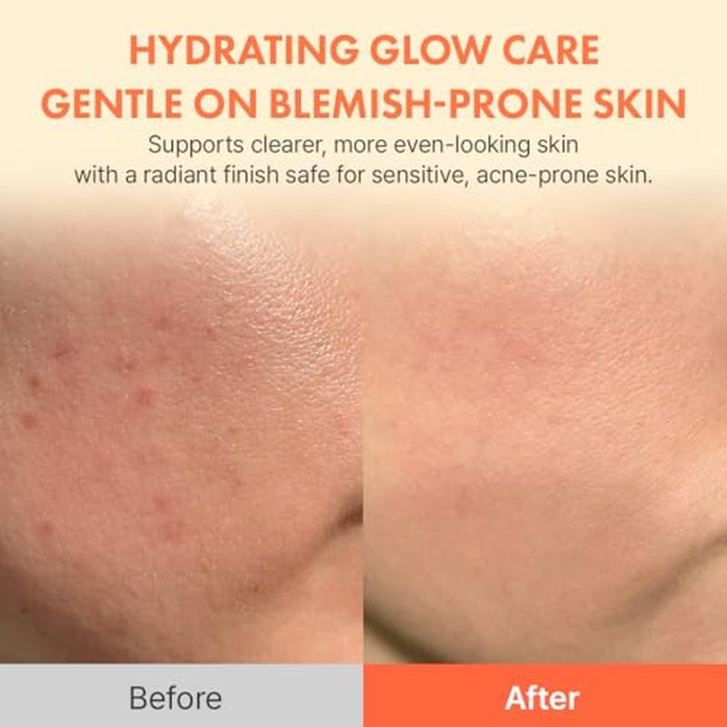 Hanskin Vitamin C Glow Serum ? Korean Brightening Facial Serum for Glowing, Radiant, Even-Toned Skin | 10% Ascorbic Acid & Vitamin C + B12 | Lightweight, Skin-Boosting Daily Serum | 1.01 fl oz