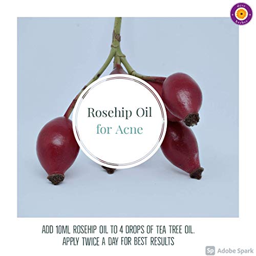 d?ve herbes Rosehip Oil (Rosa rubiginosa) | Cold Pressed | Pure | Natural | Undiluted | For Diluting Essential oils | For Skin & Massage | Non-Sticky| Lightweight| Men & Women | 50ml (1.69 oz)