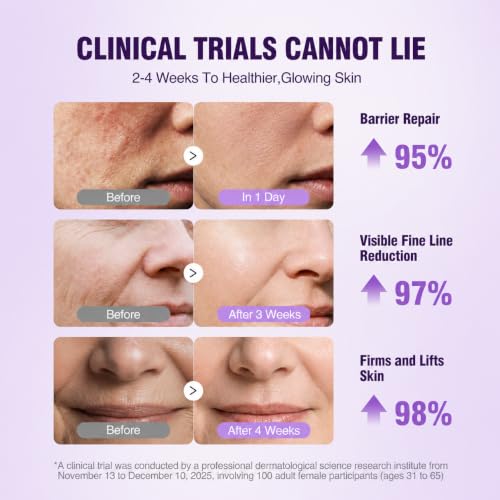 Retinol Peptide Serum for Face & Neck 1.7 Fl Oz - Firming Anti-Aging Skin Care