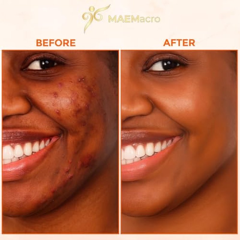 MAEMacro Turmeric & Kojic Acid soap bar with Vitamin C, Retinol, Collagen, Hyaluronic Acid, and Vitamin E | Reduce Dark Spots | Fine Lines, and Improve Skin Tone (2 Soap Bars)