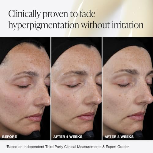 Full Size Vitamin C Serum - Brightening Face Serum with Ferulic Acid & Peptides - Refillable 15% Vitamin C