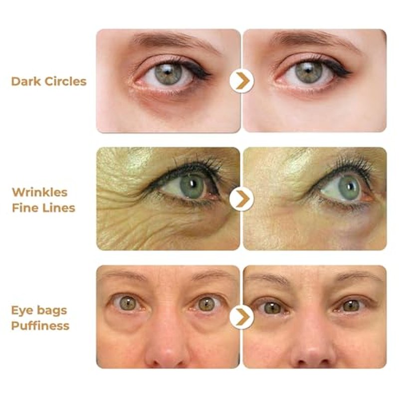 ABERA Natural Repair Eye Cream, Minimizes Under Eye Bags & Puffiness, Reduce Wrinkles, Fine Lines and Dark Circles, 0.5 fl.oz