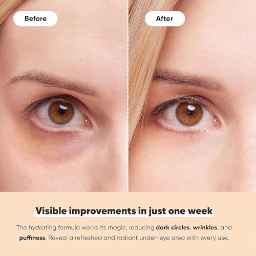 LE GUSHE K-BEAUTY Pimple Patches for Face (132 dots) & Under Eye Patches (30 Pairs). Gold Eye Mask with Collagen & Amino Acid, Cooling Eye Care for Wrinkles, Puffy Eyes & Dark Circles