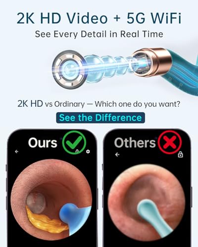 BEBIRD Ultra 2K Ear Cleaner with Camera – Wireless Otoscope for At-Home Ear Wax Removal
